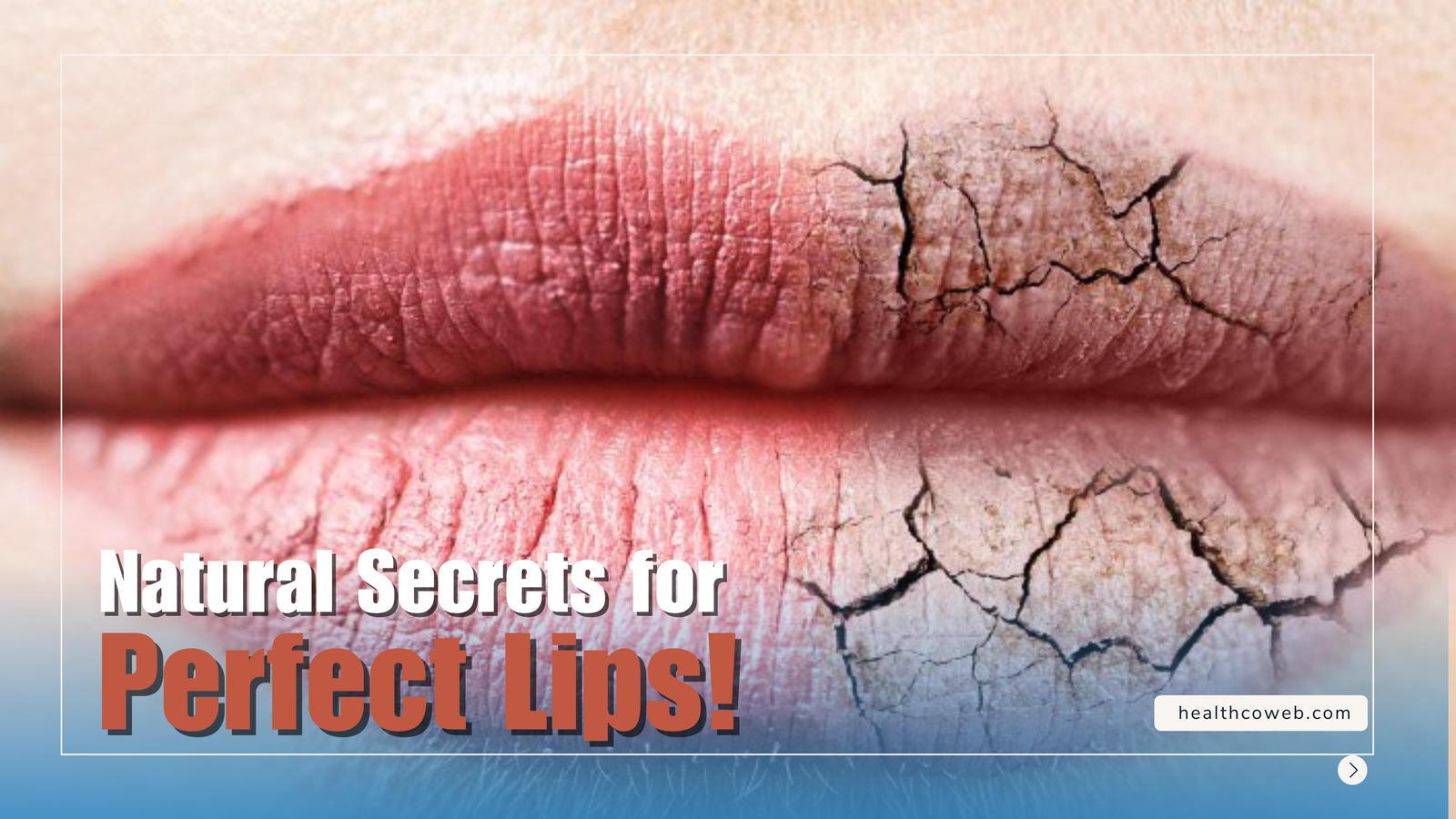 5 Simple Tricks to Make Your Lips Soft and Pink